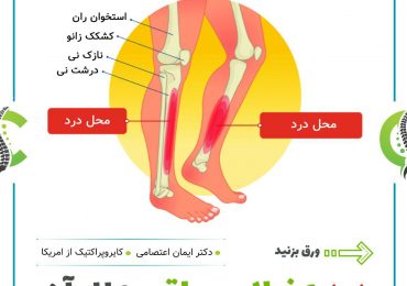 درد جلوی ساق پا و علل آن